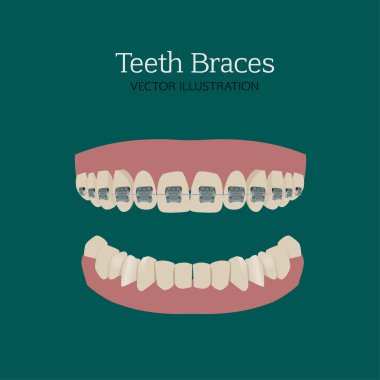 Teeth braces ve clipart