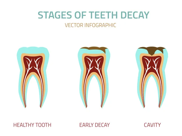 Ícone do vetor de dentes —  Vetores de Stock
