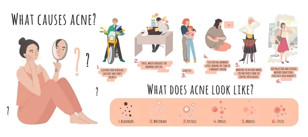 O que causa acne. Cartaz de paisagem com informações úteis —  Vetores de Stock
