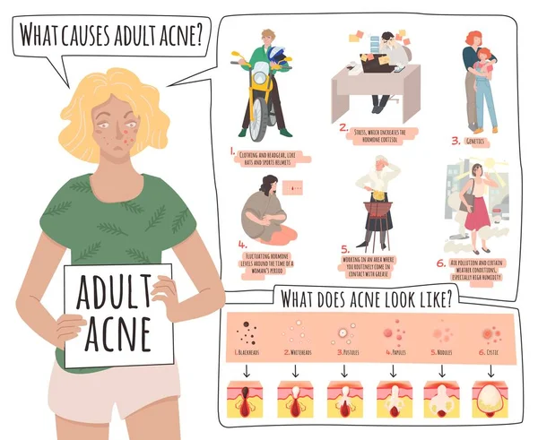 Che cosa causa l'acne. banner medico paesaggistico con informazioni utili. — Vettoriale Stock