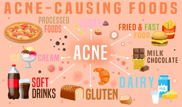 Che cosa causa l'acne. Cibo che causa l'acne. Manifesto orizzontale — Vettoriale Stock