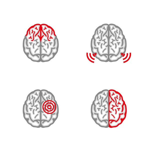 Brain Pain Icon — Stock Vector