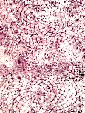 Dekoratif dantel doku