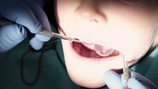 Rapazinho Com Dentes Danificados Fazer Tratamento Odontologia Close — Vídeo de Stock