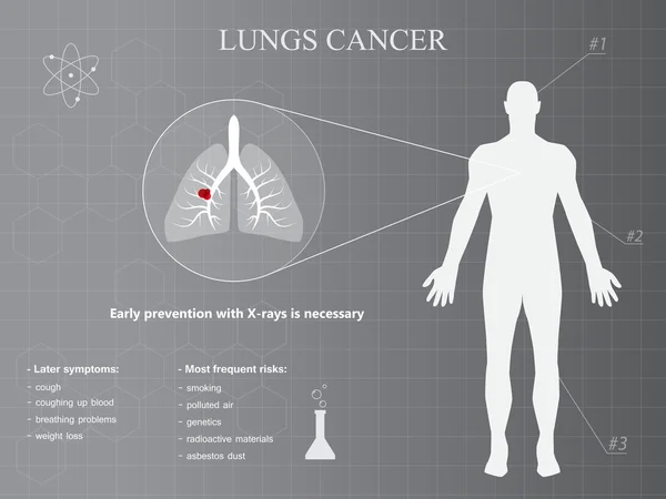 带有灰色背景的肺部癌症数据图表 — 图库矢量图片