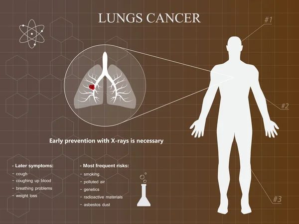 肺部癌症信息图表与棕色背景 — 图库矢量图片