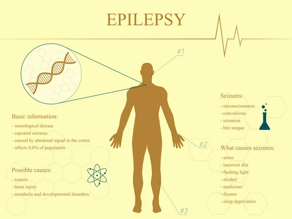 Infographie de la maladie de l'épilepsie avec silhouette homme — Image vectorielle