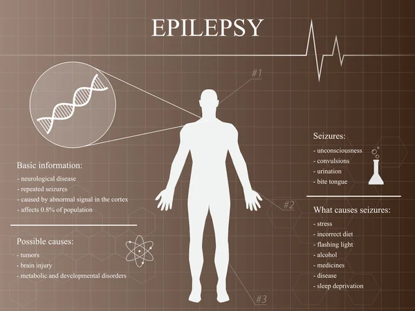 Infografía de la enfermedad de la epilepsia con silueta del hombre — Archivo Imágenes Vectoriales