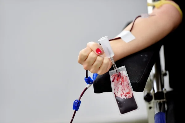 Рука донора крові з закритим кулаком — стокове фото