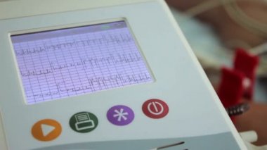 EKG EKG Elektrokardiyografi cihazı monitör