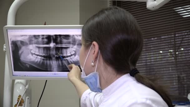 Dentista Muestra imagen de rayos X en la pantalla — Vídeos de Stock