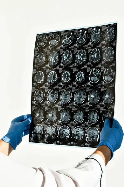 Doctor Protecting Gloves Holding Brain Mri Medical Office Mri Scan — Stock Photo, Image