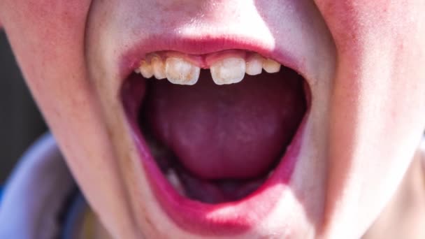 口で幼児は歯の検査で低い赤ん坊の歯を示すために広く開いた。4kズームイン — ストック動画