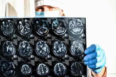 Tıp ofisinde beyin MR 'ı tutan eldivenleri koruyan doktor. Klinikteki insan kafasının MR taraması. Profesyonel beyin doktoru hastaya danışmanlık yapar.