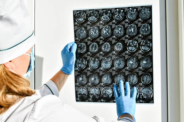 Médico Protección Guantes Con Resonancia Magnética Cerebral Consultorio Médico Resonancia —  Fotos de Stock