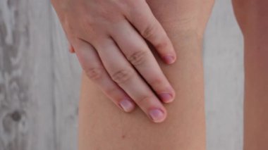 Bacağında morluk olan tanınmayan bir kadın. Bacağındaki leke yarasını kapat. Spor aktivitesi travmasının hematom kan sonuçlarının iyileşmesi. Ekstradan mavi, deride mor.