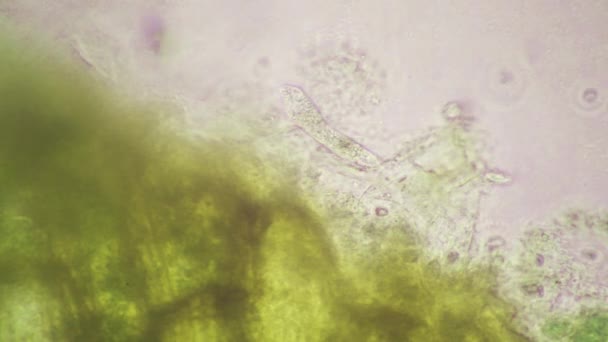 Lacrymaria Olor Phylum Ciliati Mikroskobik Manzara — Stok video