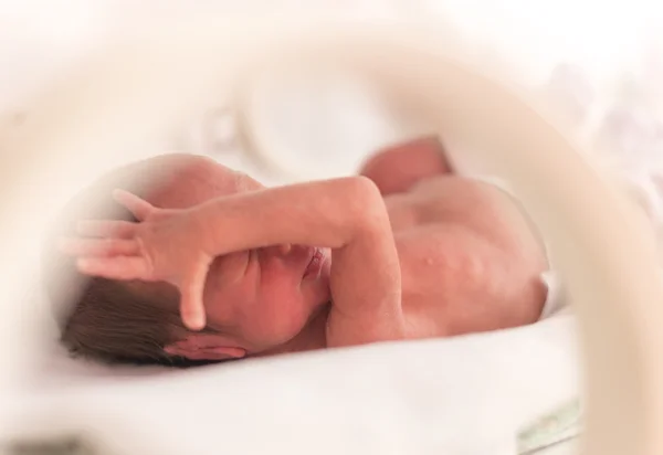Předčasné novorozená holčička — Stock fotografie