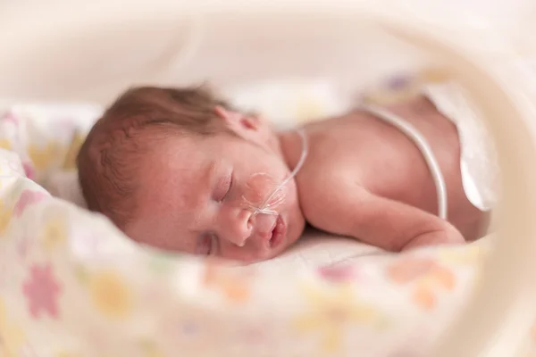Преждевременная новорожденная девочка — стоковое фото