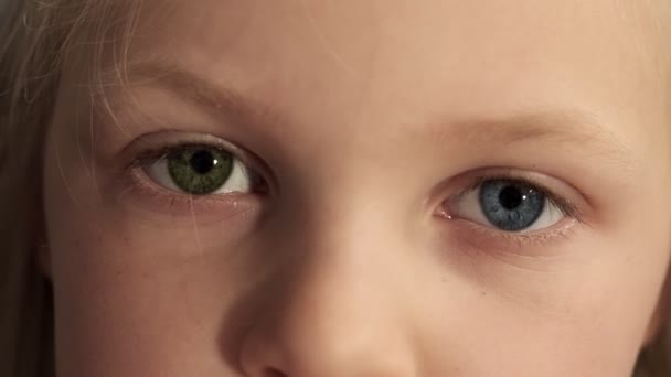 Close Little Kid Eyes Different Colors Child Complete Heterochromia Blue — Stock Video