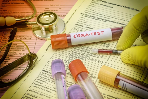 Krevní vzorek pacienta s Ebolou, pozitivní výsledek, koncepční obraz — Stock fotografie