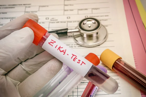 Tests for Research Of Zica virus (ZIKV ) — стоковое фото