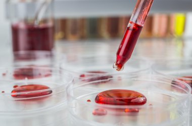 Laboratuvar plastik pipet kırmızı sıvı ve ortaya çıkan d dolu