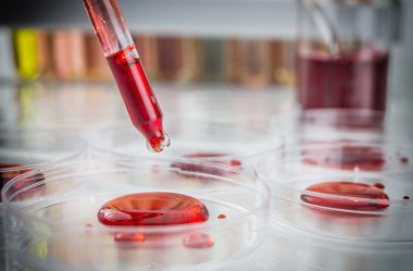 Laboratuvar plastik pipet kırmızı sıvı ve ortaya çıkan d dolu