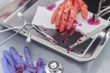 theoperating Oda aletleri, cerrahi bir müdahale sırasında el nakli