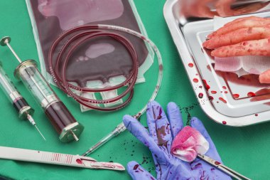 Kırmızı kan hücreleri, Kan durdurucu sargı Kocher forcep konsantre birimi