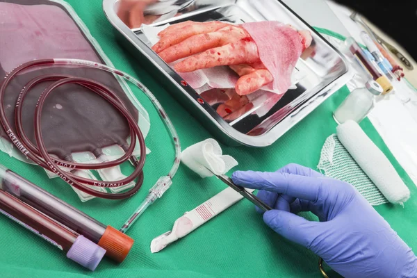 Unidad de concentrado de glóbulos rojos, hemostático Kocher forcep — Foto de Stock