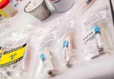 Sars-cov2 virüslü insanlardan kan örnekleri, Rt-PCR için önleyici maddeler, kavramsal görüntü