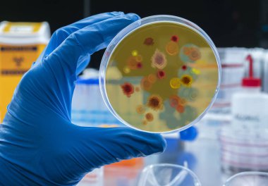Scientist examines malaria virus on petri dish in laboratory, conceptual image clipart