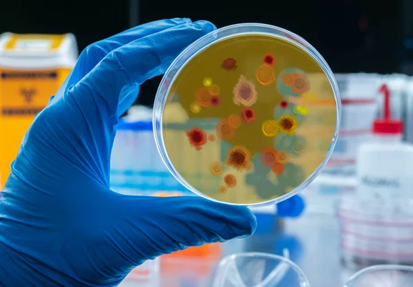 Cientista Examina Vírus Malária Placa Petri Laboratório Imagem Conceitual — Fotografia de Stock