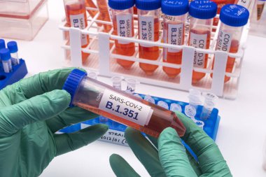 Bilimsel olarak 20H / 501Y.V2 veya B.1.351 olarak bilinen Güney Afrika sars-cov-2 'nin yeni bir tür laboratuvar araştırması, kavramsal resim