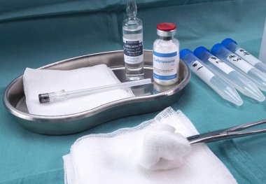 Oxford kovid-19 aşısı enjekte edildikten sonra transvers miyelit hastalarda serebrospinal sıvıyı çıkarmak için anestezi ve antibiyotikle birlikte lumbar ponksiyon iğnesi.