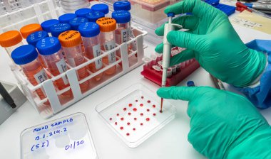 Bilimsel adı B.1.214 olan Spike Insertion (SI) olarak bilinen Belçika 'daki Sars-Cov-2 mutasyonunun laboratuvar analizi, kavramsal görüntü