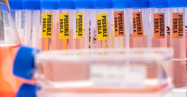 Blutprobe Von Ebola Patient Positives Ergebnis Konzeptionelles Bild — Stockfoto