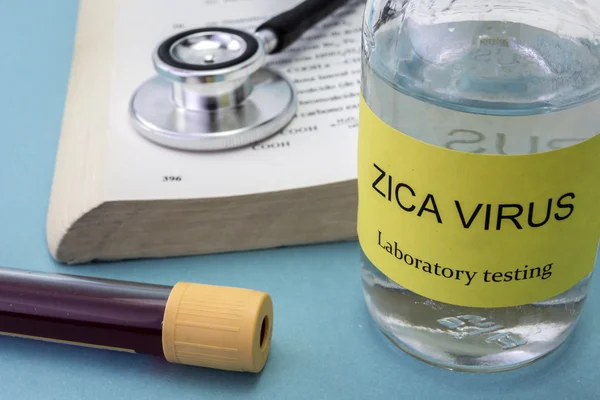 Pruebas para la investigación del virus Zica (ZIKV ) — Foto de Stock