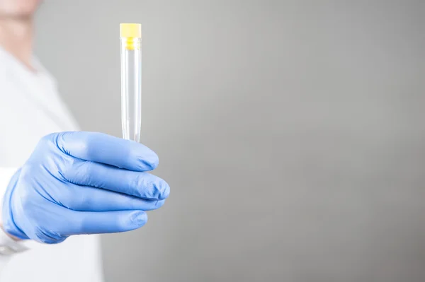 Test tube with blood, test tube with fluid, — Stock Photo, Image