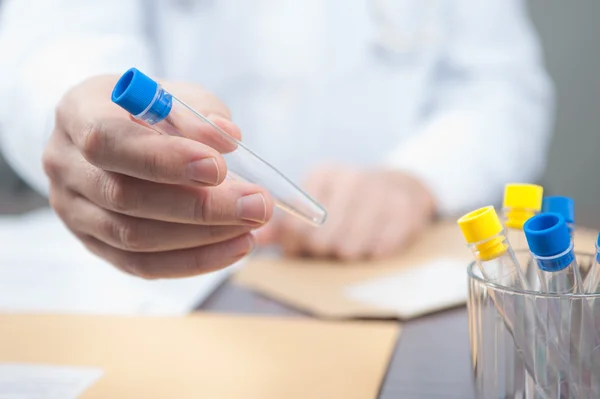 Test tube in doctor hand, test tubes on the desk, empty test tube, doctor give test tube, — Stock Photo, Image