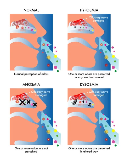 Illustration Showing Symbolic Simple Way Symptoms Three Different Olfactory Disorders — Stock Vector