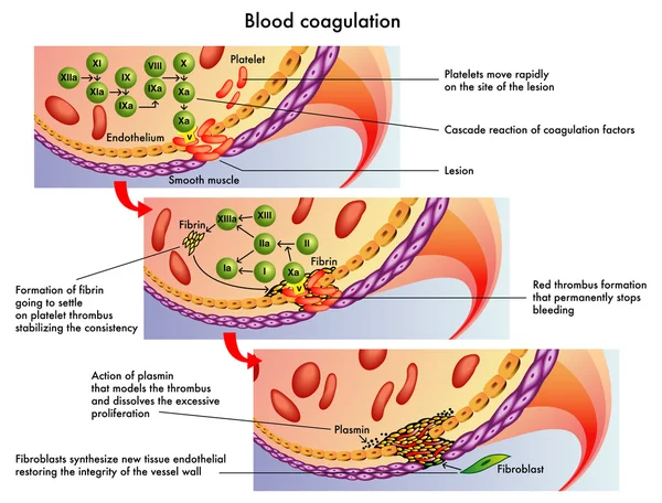 Blood coagulation — Stock Vector