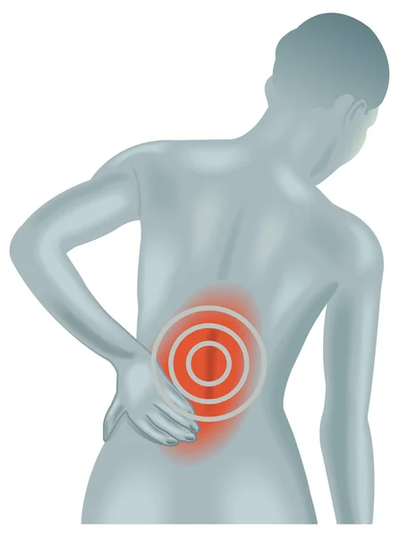 Back Pain — Stock Vector