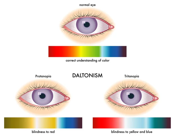 Daltonism — стоковий вектор