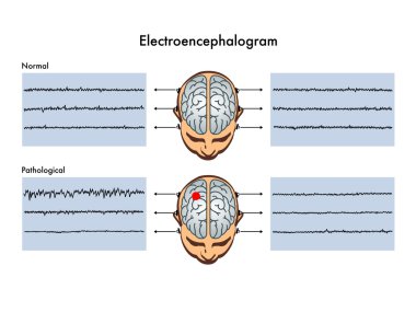 Ayrıntılı insan Electroencephalogram