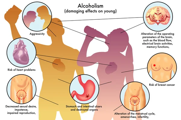 Alcoholismo juvenil humano — Vector de stock