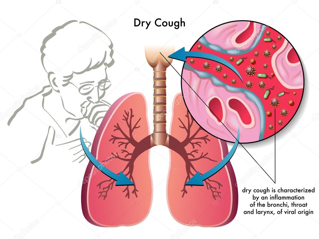 Human Dry Cough