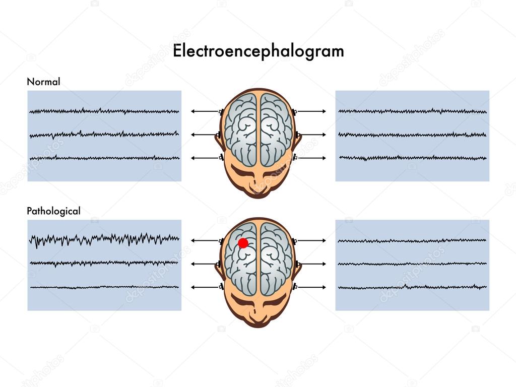 Detailed human Electroencephalogram