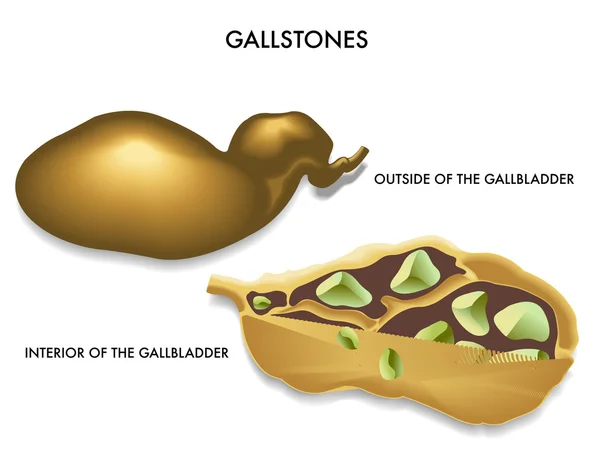 Dwarsdoorsnede van de galblaas — Stockvector